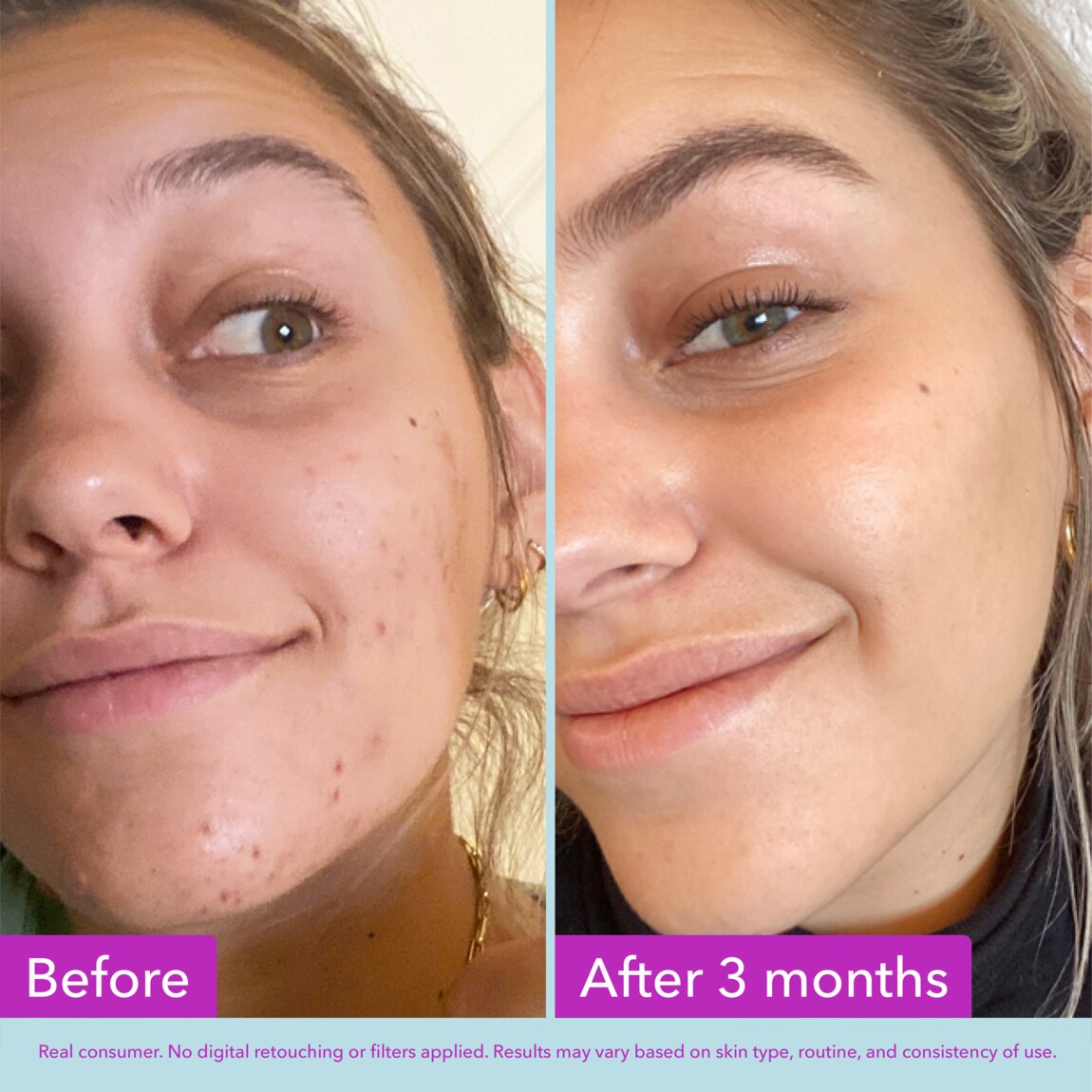 niacinamide-brightening-toner-k7 zb_p.jpg