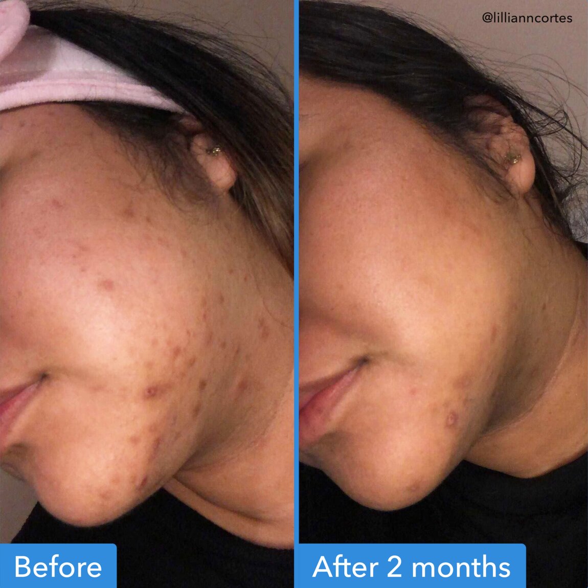 discoloration-correcting-serum-j2 zb_p.jpg
