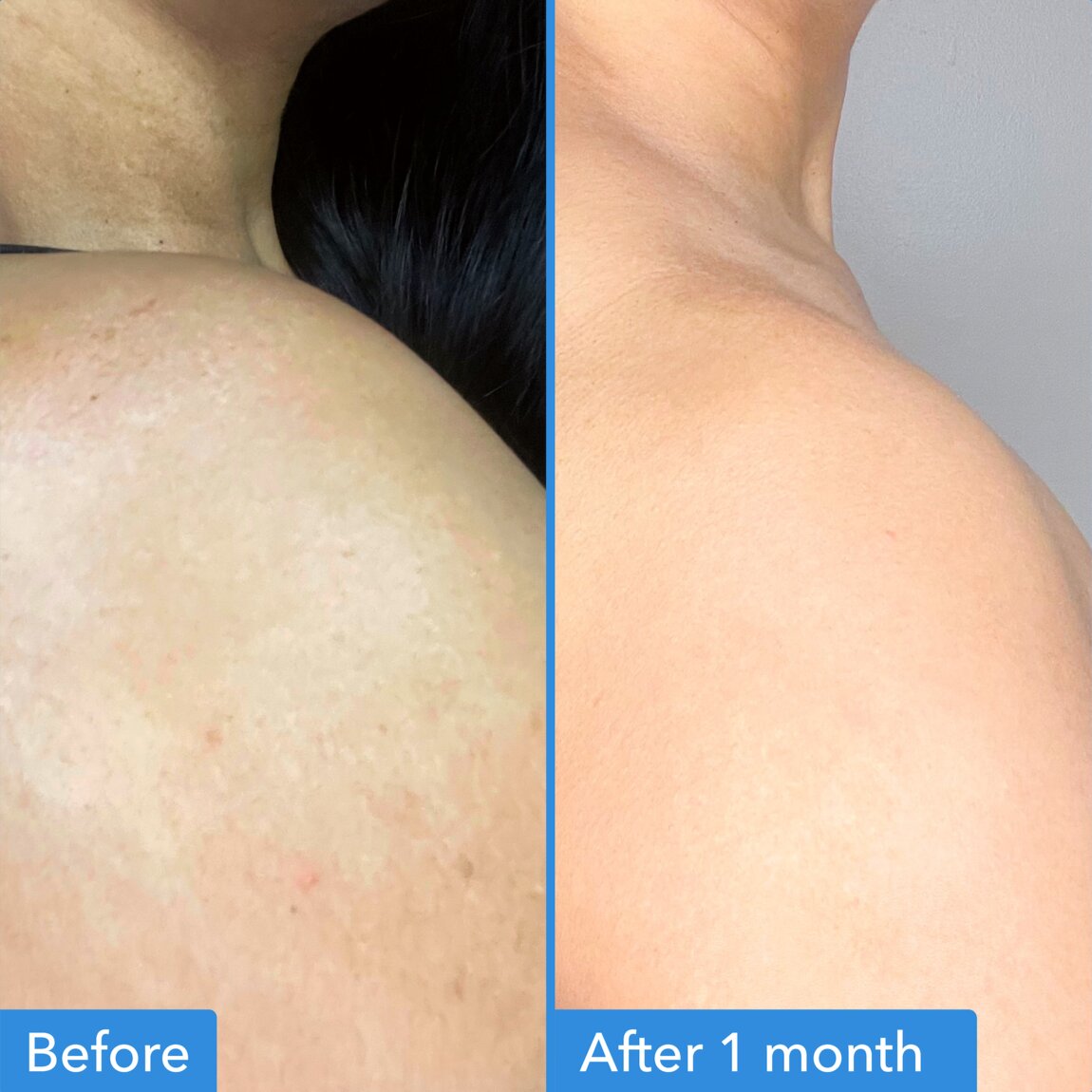 discoloration-correcting-body-treatment-z8 zb_p.jpg