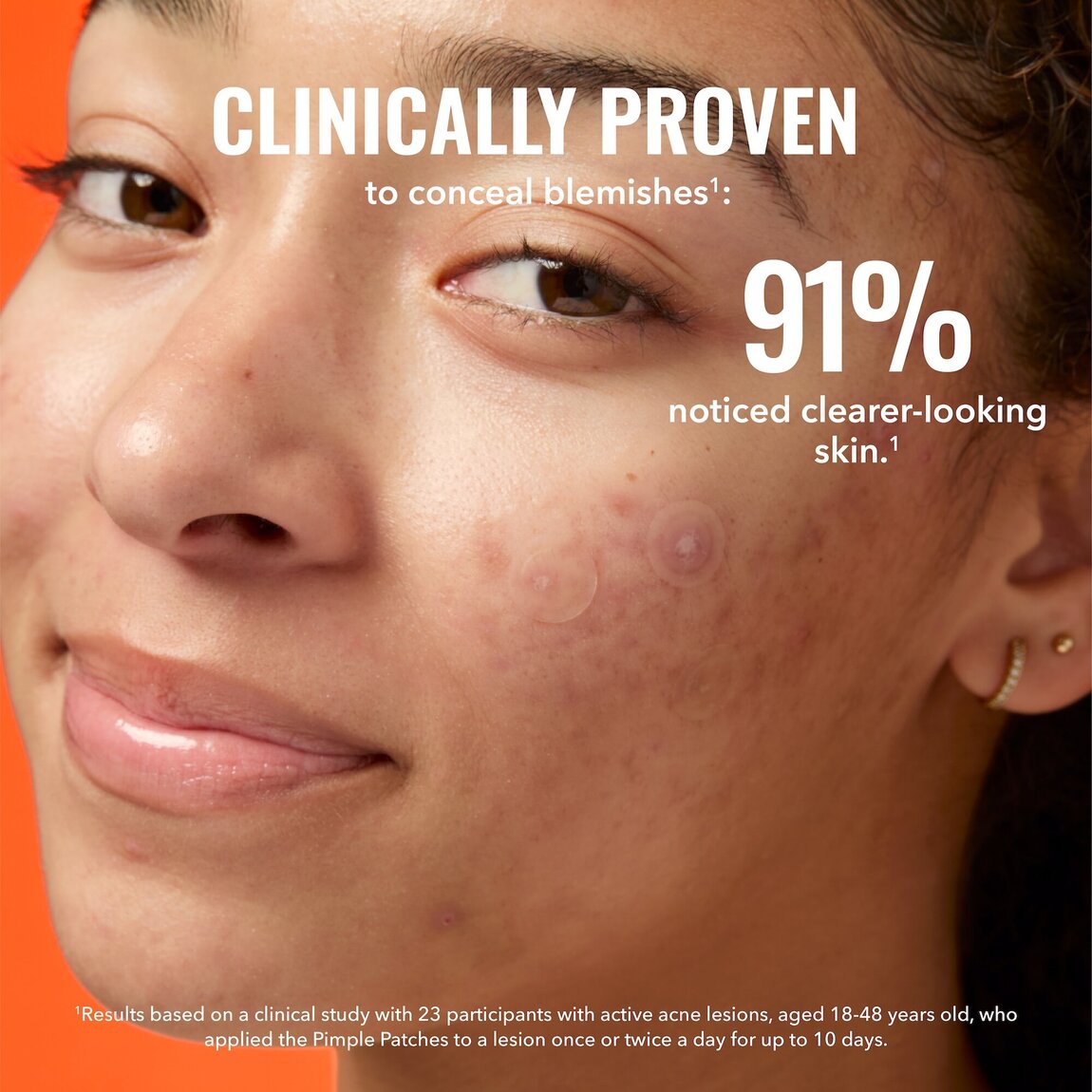 pimple-patches-c9 zb_p.jpg